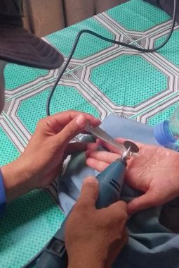 Jari Warga Serpong Utara Bengkak Karena Cincin Tak Bisa Dilepas, Damkar Turun Tangan