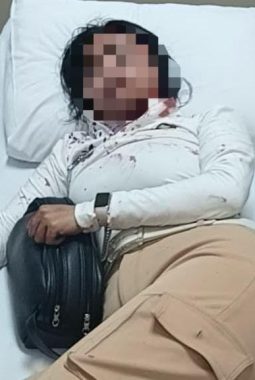 Caddy Golf di Tangerang Alami Wajah Lebam Hingga Robek Kepala Usai Alami Penganiayaan